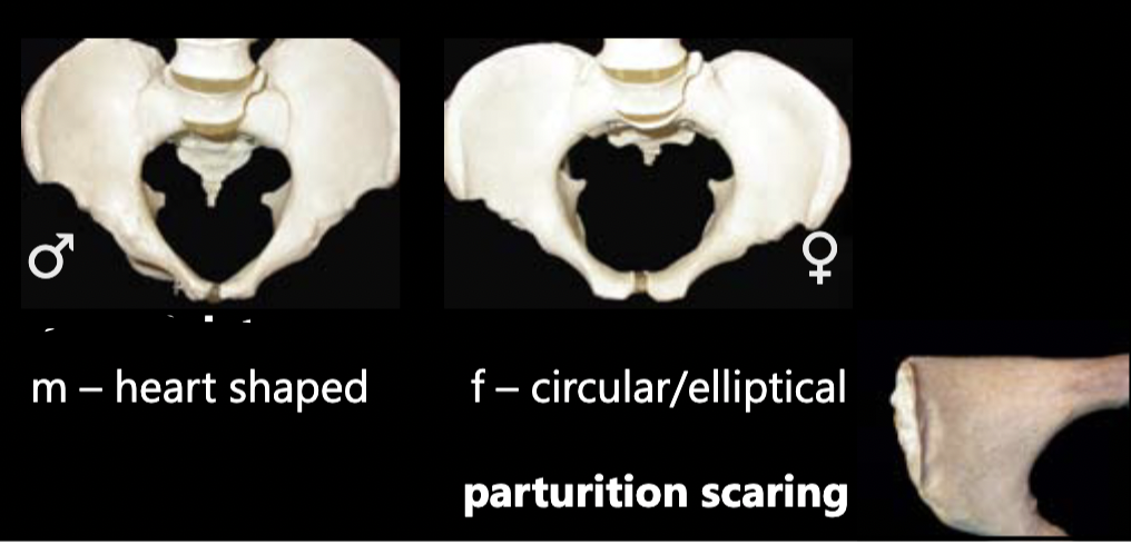 <p>M: heart-shaped F: circular/elliptical, parturition scarring</p>