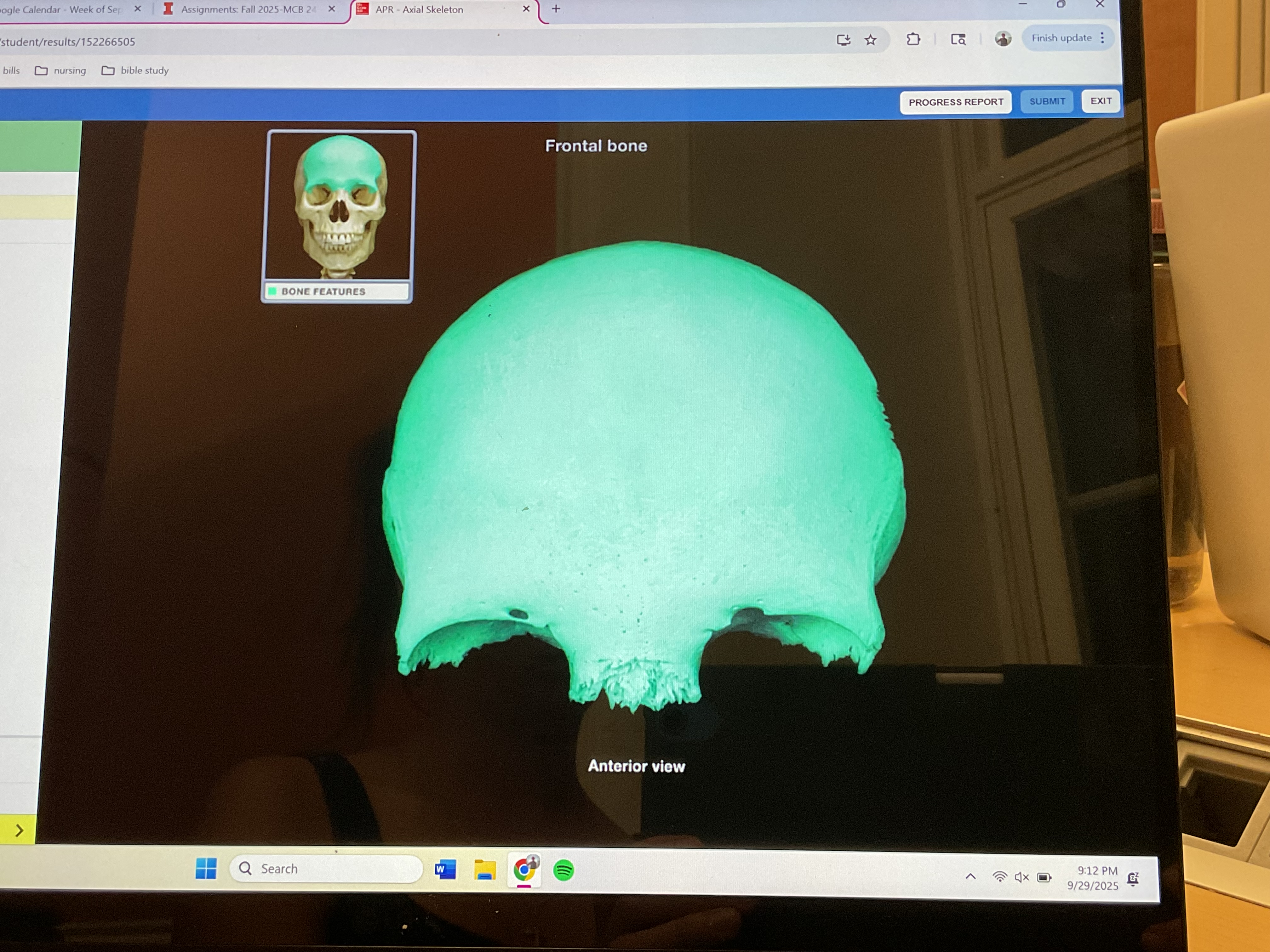 <p>Frontal bone </p>