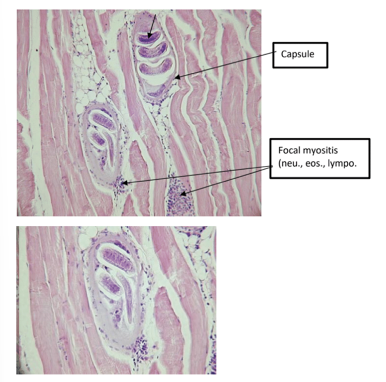 <p><strong>trichinellosis musculorum</strong></p>