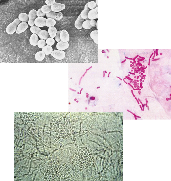 <p>A <strong>budding yeast</strong> with <strong>short, branching hyphae</strong> that align end-to-end and are <strong>not a dermatophyte</strong>.</p>