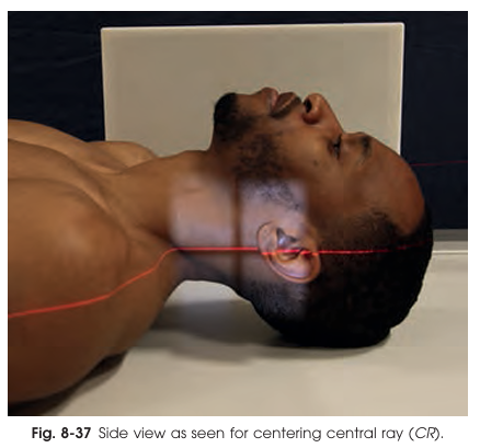 <p>Where is the central ray directed for the lateral projection of the atlas and axis?</p>