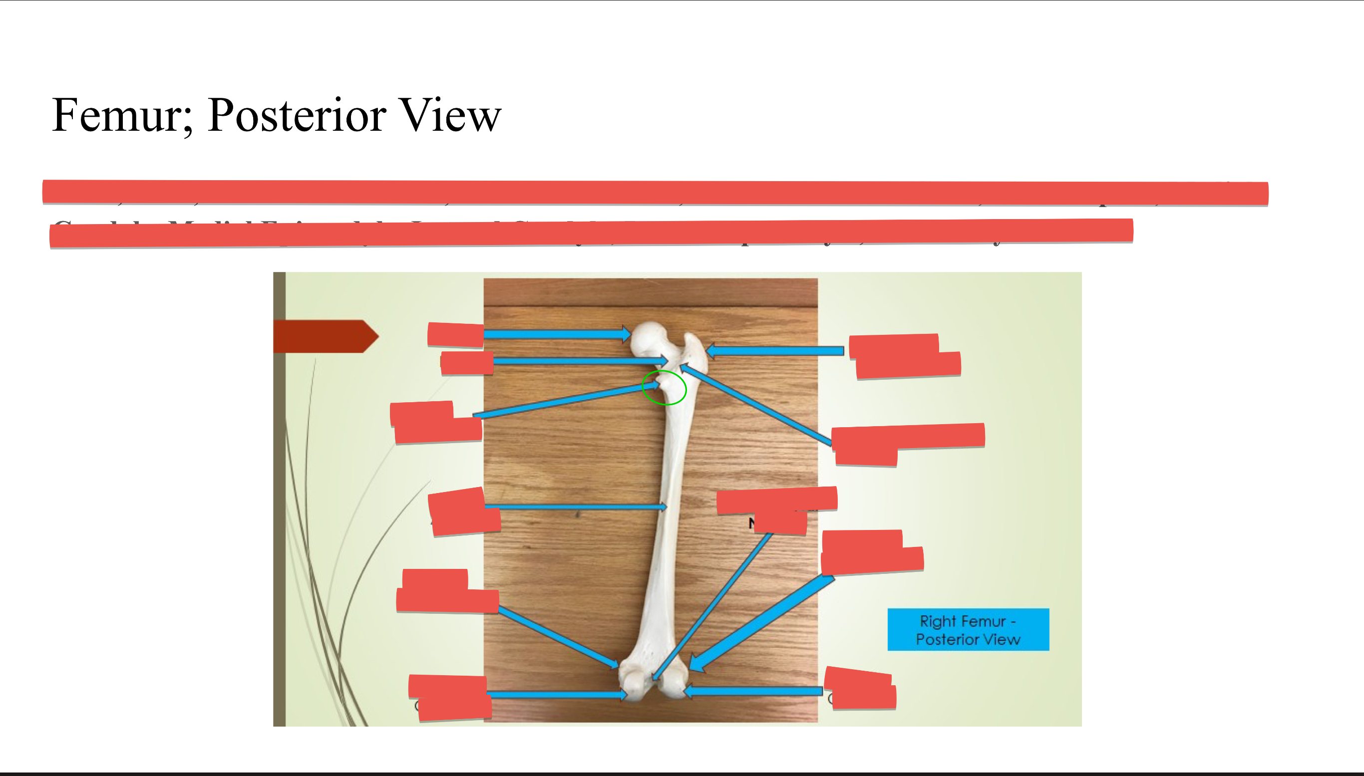 <p>Lesser trochanter</p>