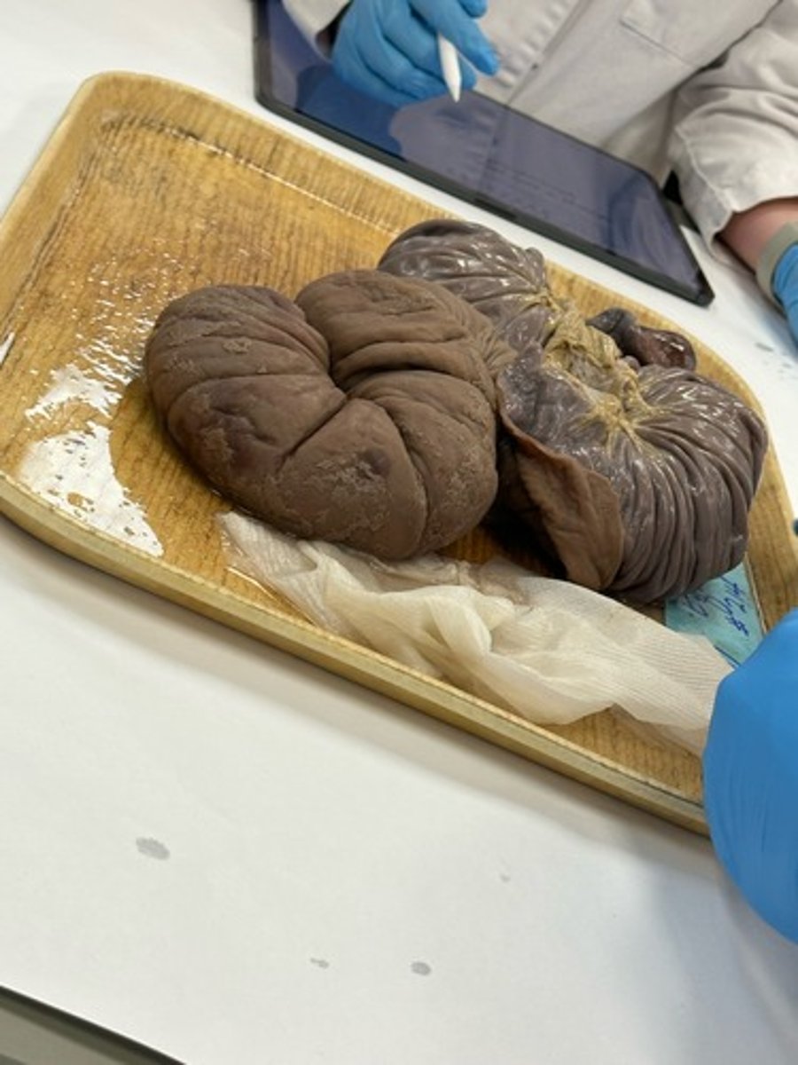 <p>What is the lesion?</p>