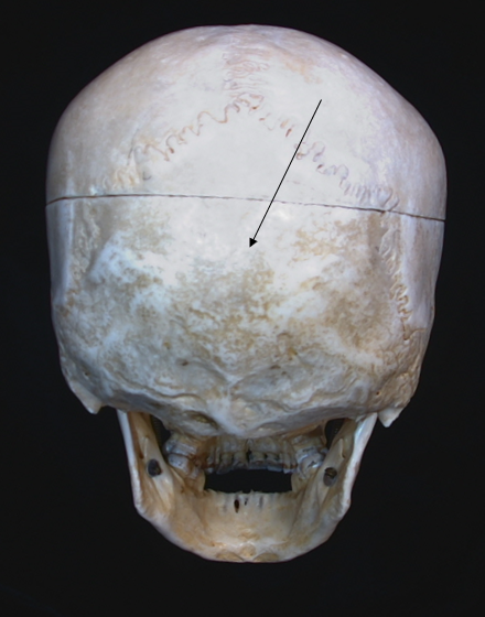 name the bone 