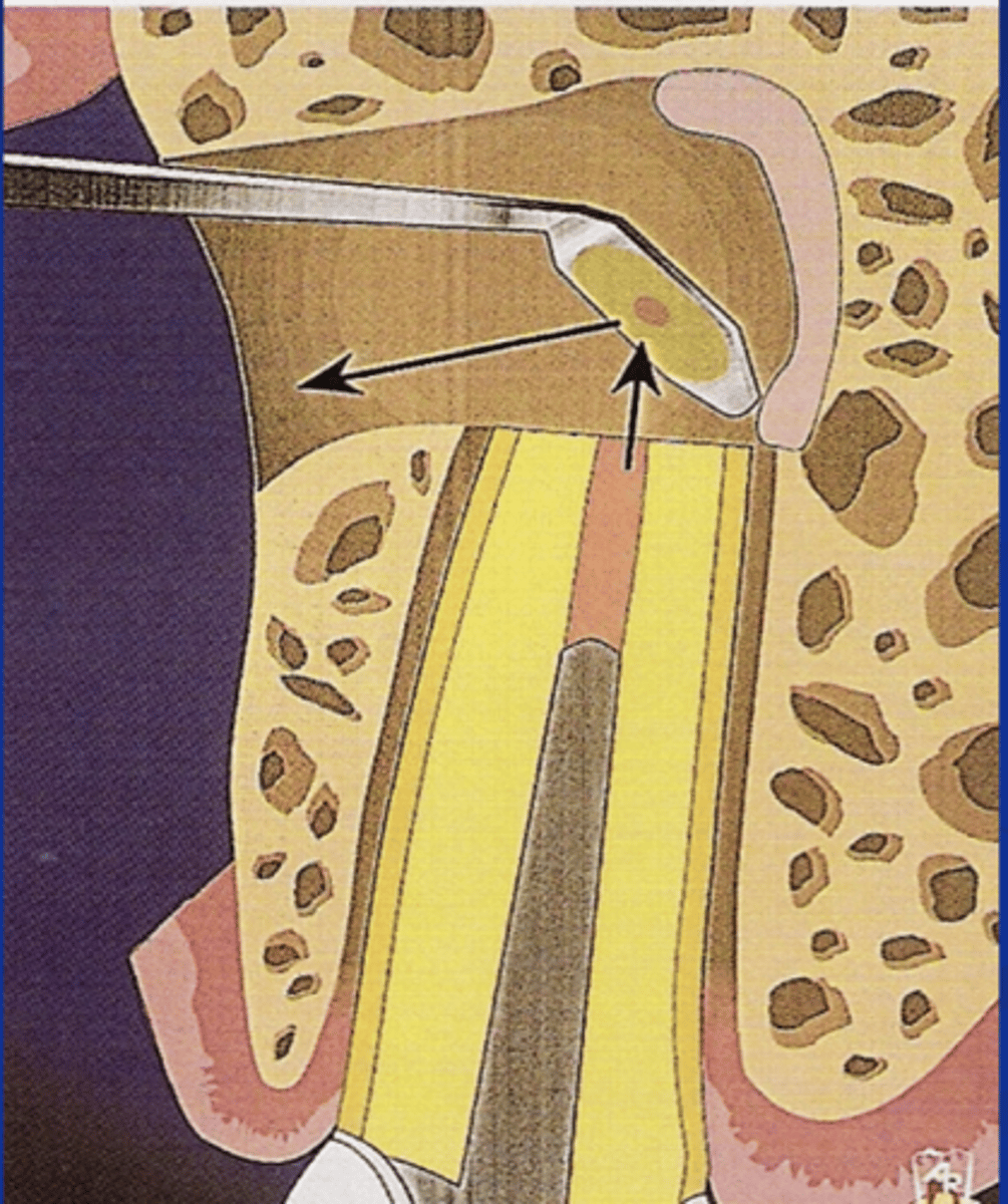 <p>ID the surgical procedure:</p>