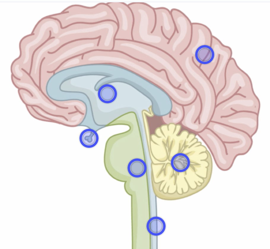 <p>Label this diagram of the brain</p>