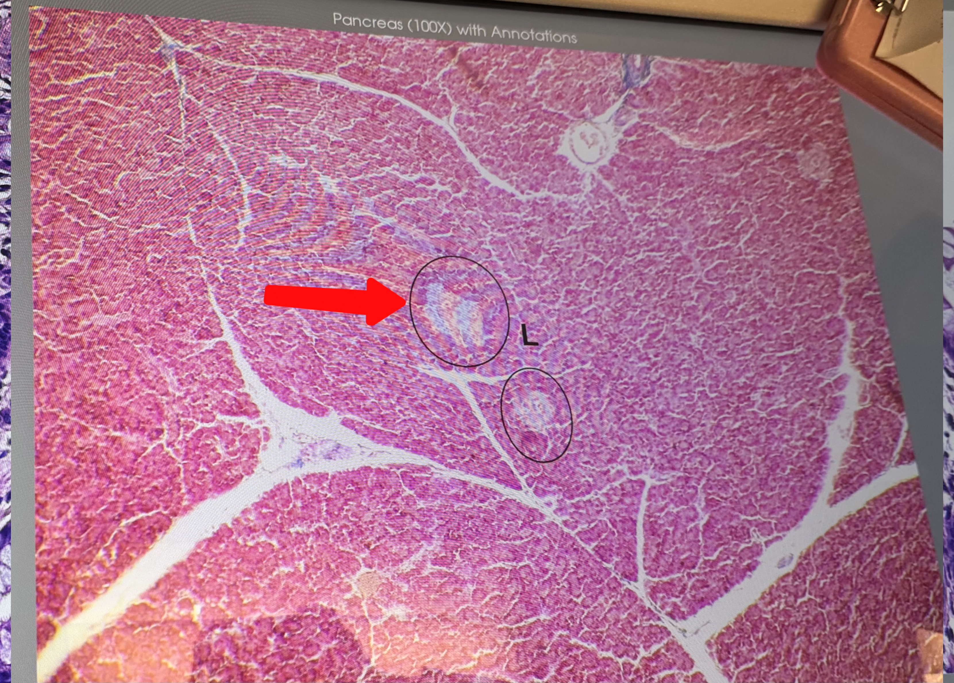 <p>Páncreas: what is this?</p>