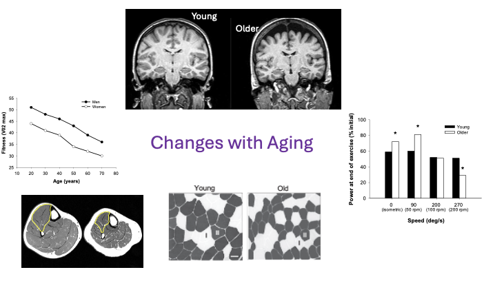 <p>cross sectional- not tracking a person over over time, they are diff groups of people of different ages</p>