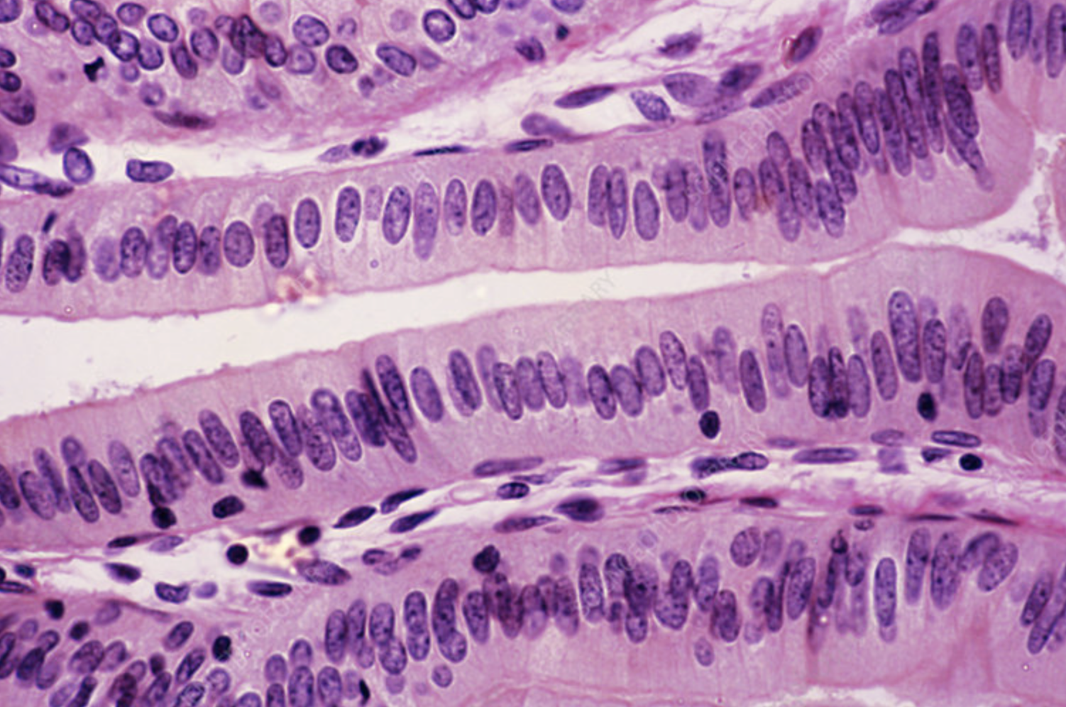 <p>they attach to columnar epithelial cells </p>