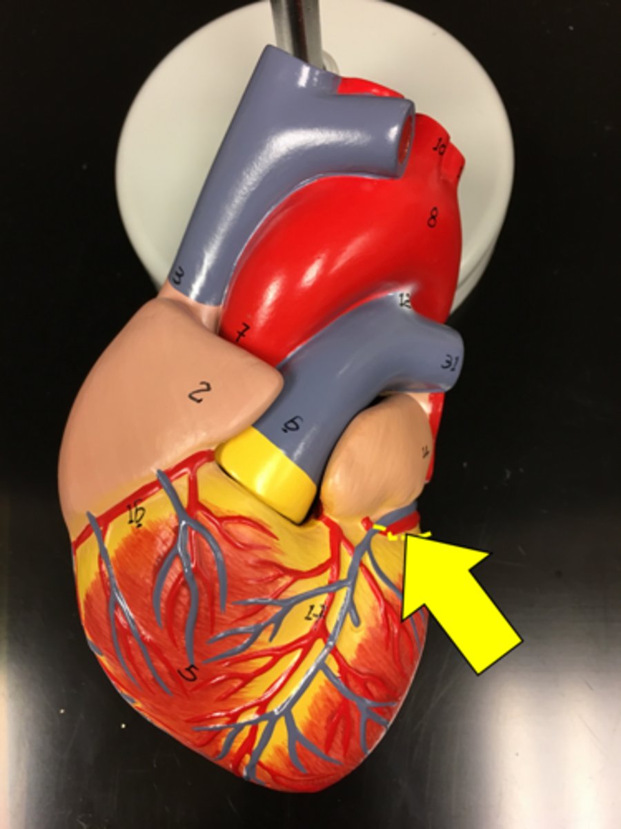 <p>Name the red vessel.</p>