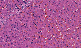 <p><span>Which of the following is true about the cells pictured below?&nbsp;</span></p><ol><li><p><span>They are liver hepatocytes</span></p></li><li><p><span>They store glucose in the form of glycogen</span></p></li><li><p><span>They have connections to bile canaliculi to secrete exocrine bile</span></p></li><li><p><span>All of the above</span></p></li></ol><p></p>