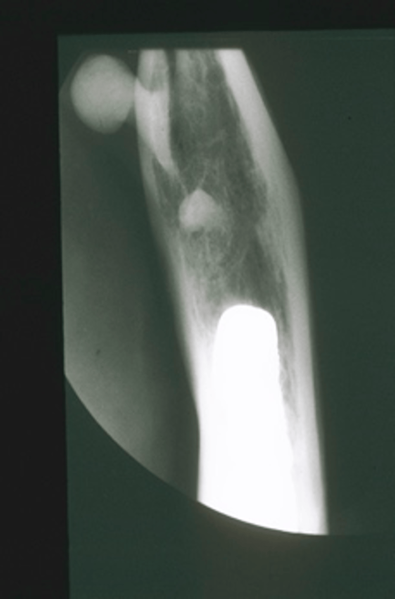<p>ID the pathology:</p>