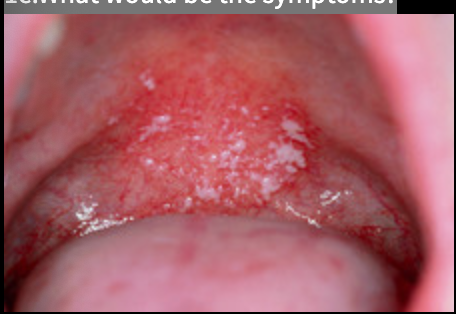 <p>1e.What would be the symptoms?</p>