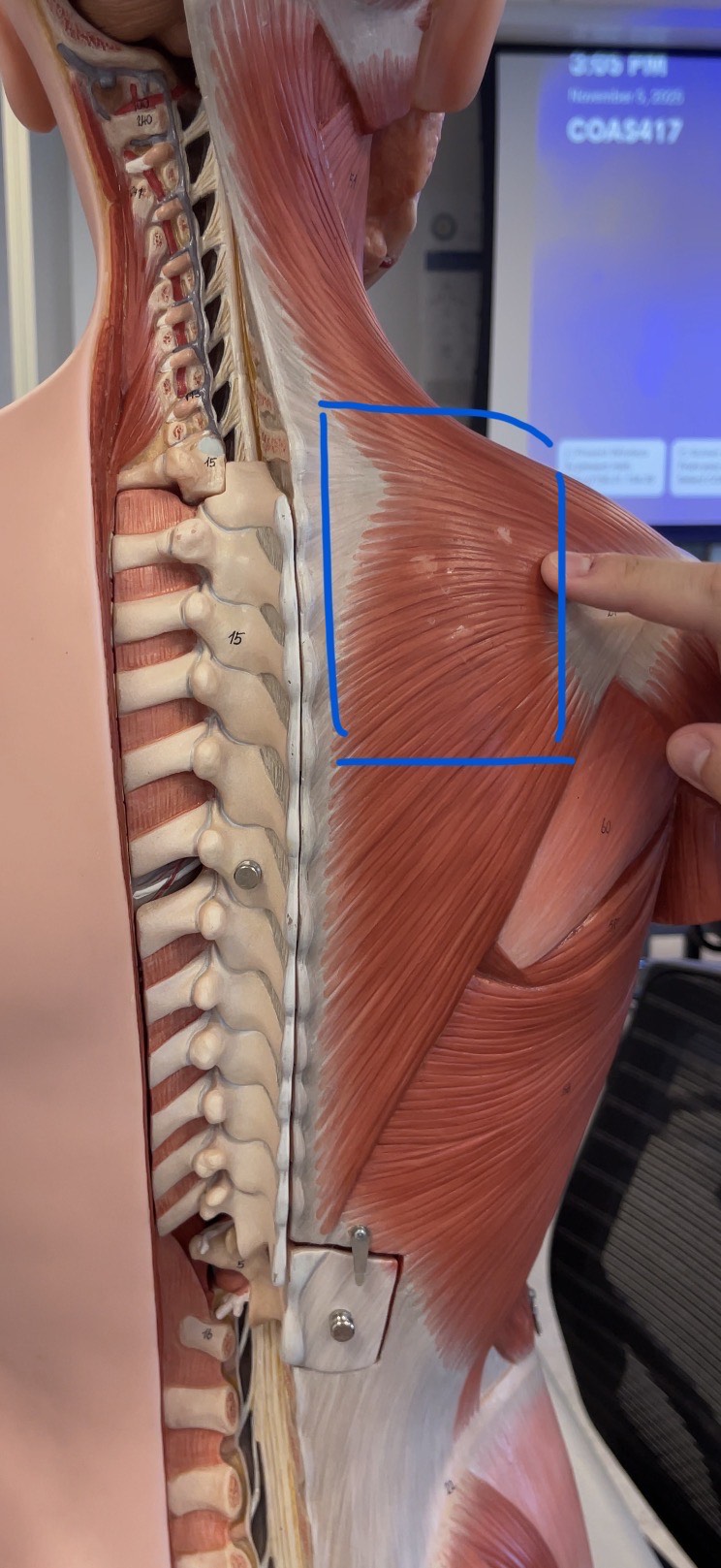 <p>Underneath Trapezius</p>