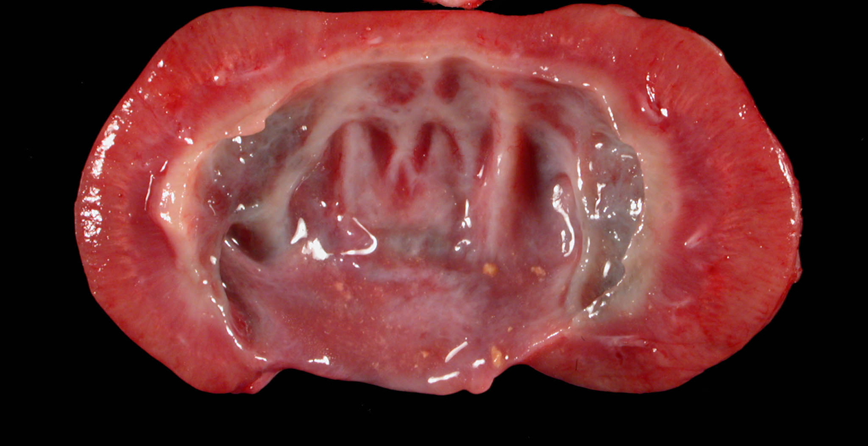 <p>What organ is this? Give a morphological description, morphological diagnosis, disease diagnosis, and pathogenesis</p>