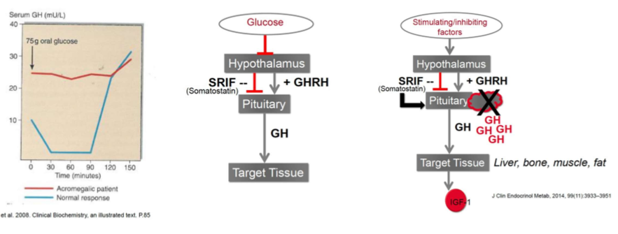 <p>Giving glucose should suppress GH release in body. Failure to suppress GH release indicates acromegaly</p>