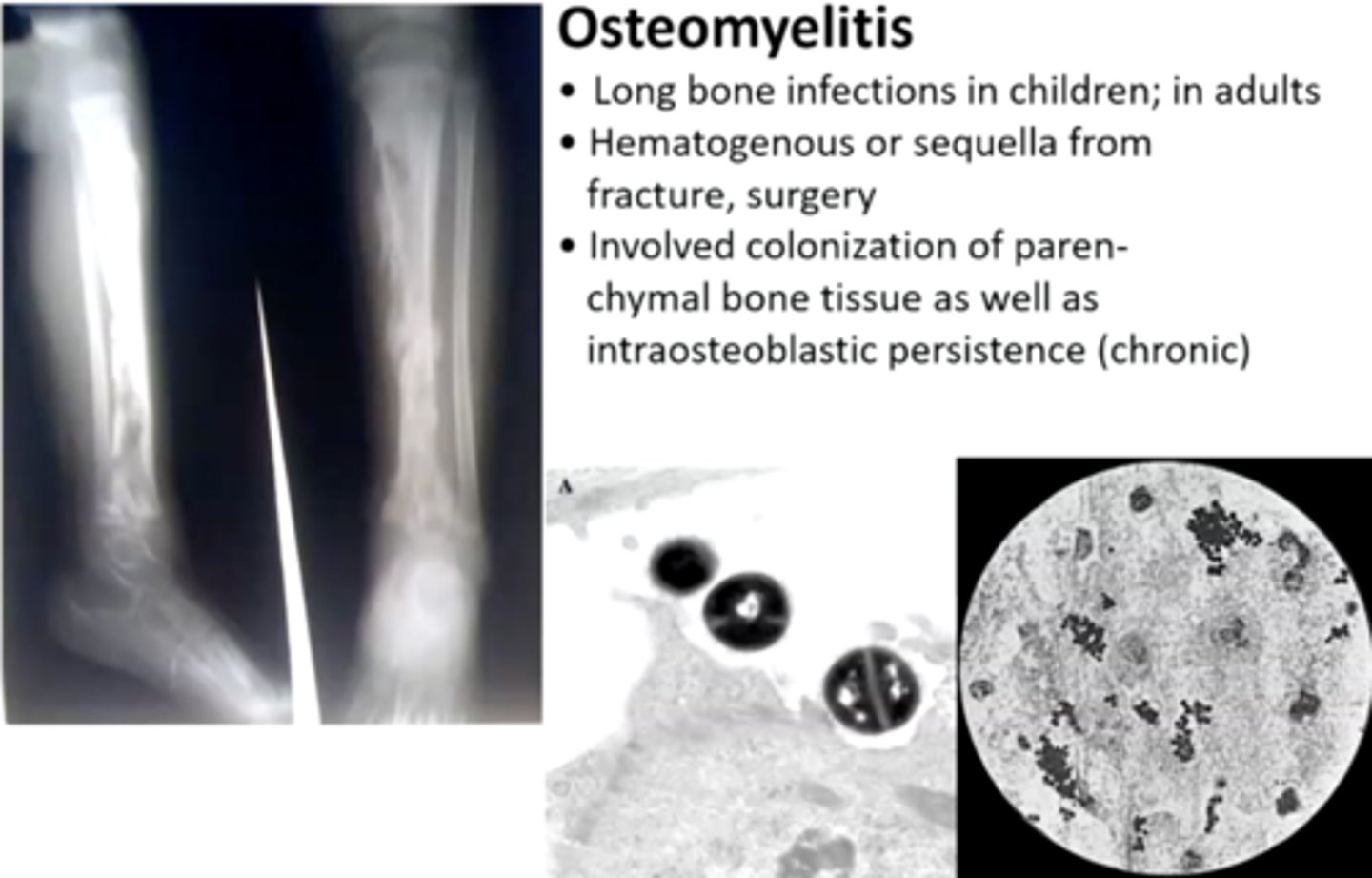 <p>Hypovascularity</p>