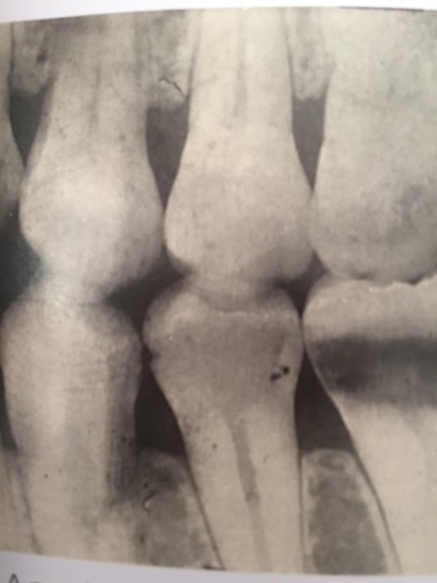 <p>cause film to be too light, fogged, or tinted brown</p><p>exhausted fixer pictured</p>