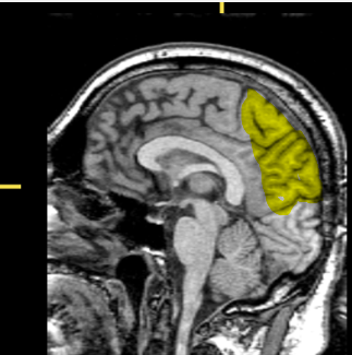 <p>What part of the brain is highlighted?</p>