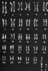 <p>Karyotype analysis</p>