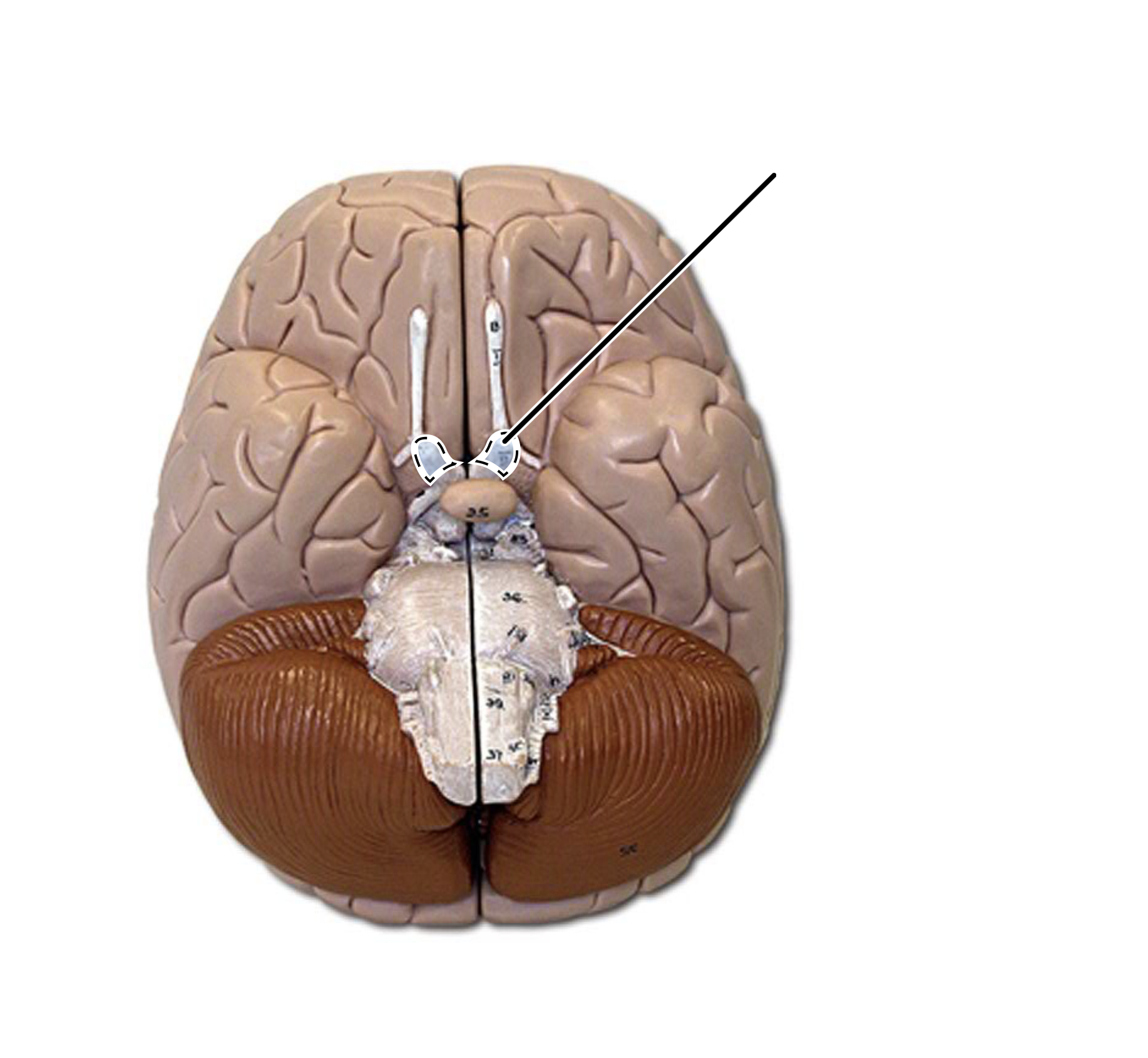 term image