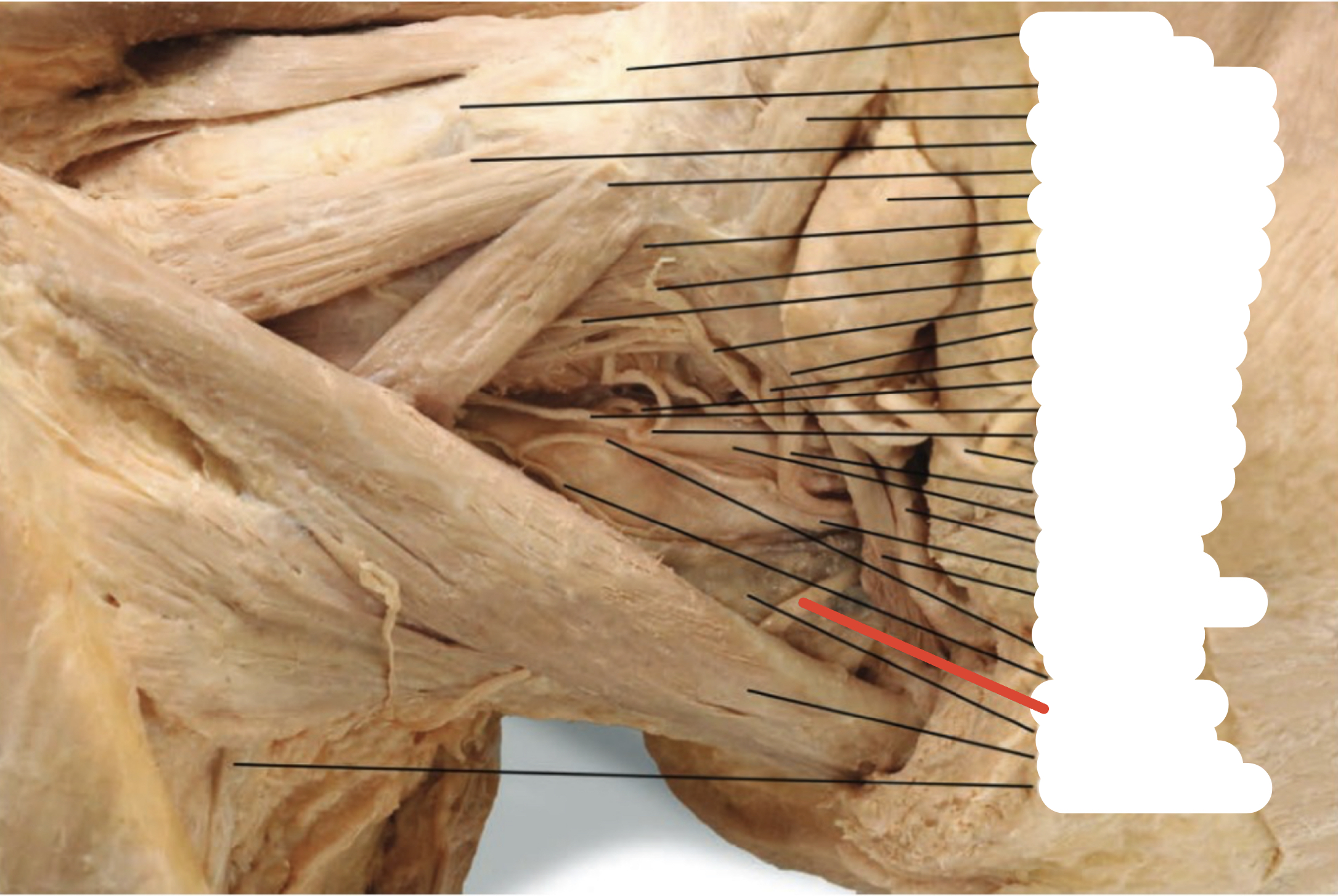 Identify the structure (red line)