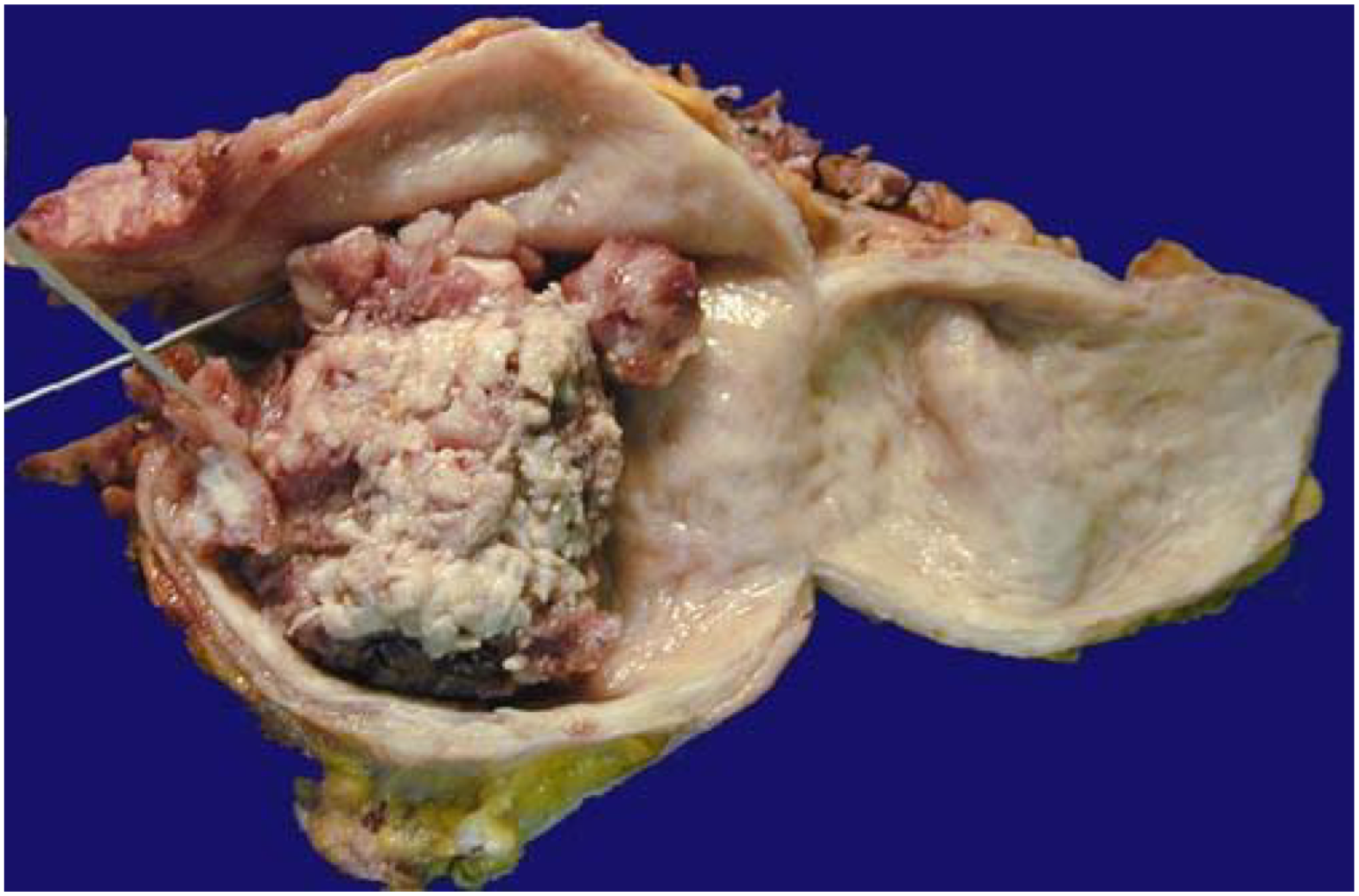 <p>what is the diagnosis?</p>