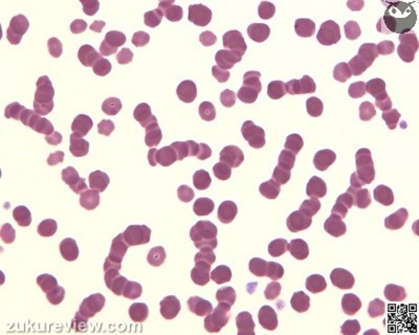 <p>In which animal is the appearance of these red blood cells a normal finding?</p><p>Dogs</p><p>Calves less than 4 weeks old</p><p>Goats</p><p>Horses</p><p>Pot belly pigs</p>
