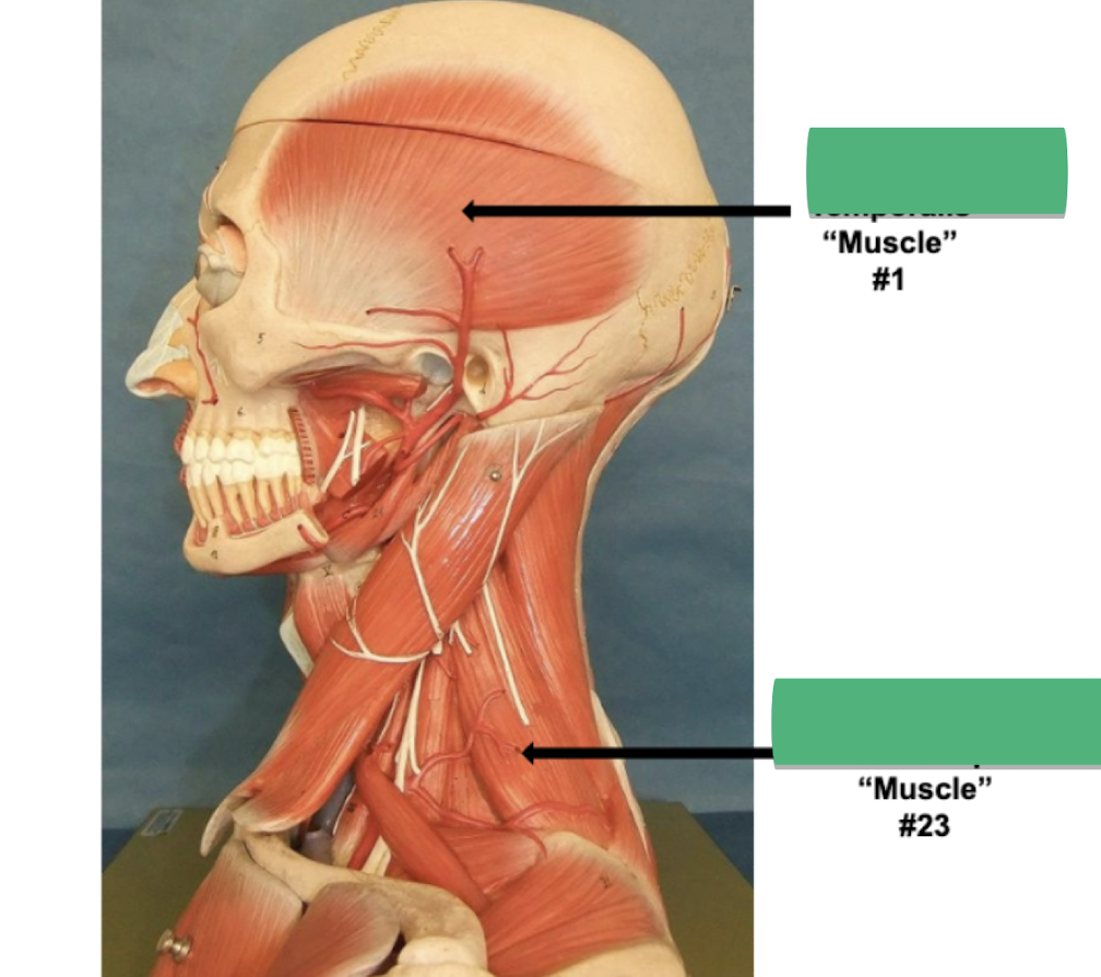 <p>Label muscle #1 </p>