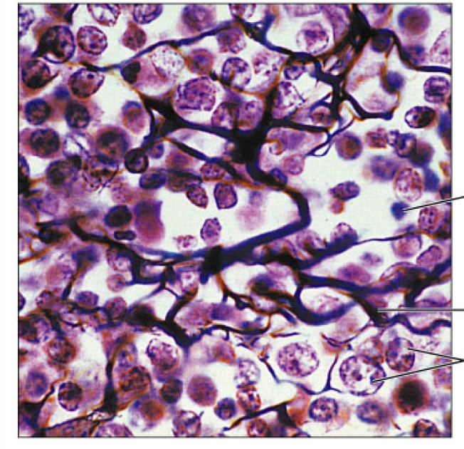 <p>reticular</p>