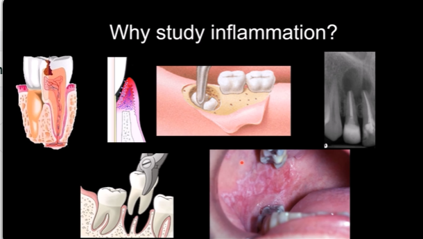 <ul><li><p>most dental procedures involve wound healing - incising the gingiva, extracting teeth</p></li><li><p>some medications impact wound healing </p></li></ul><p></p>