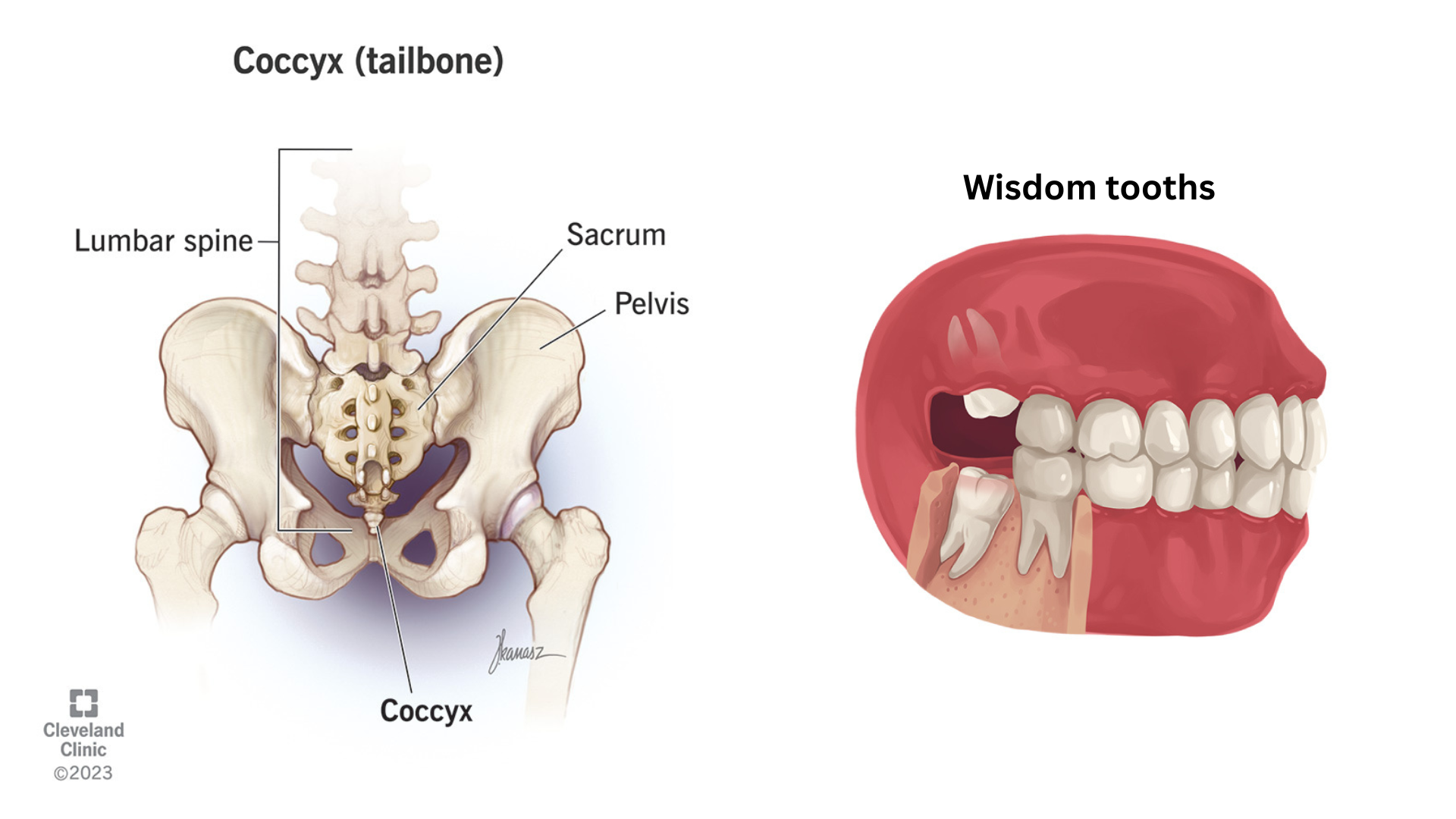 <p>Vestigial Structures</p>