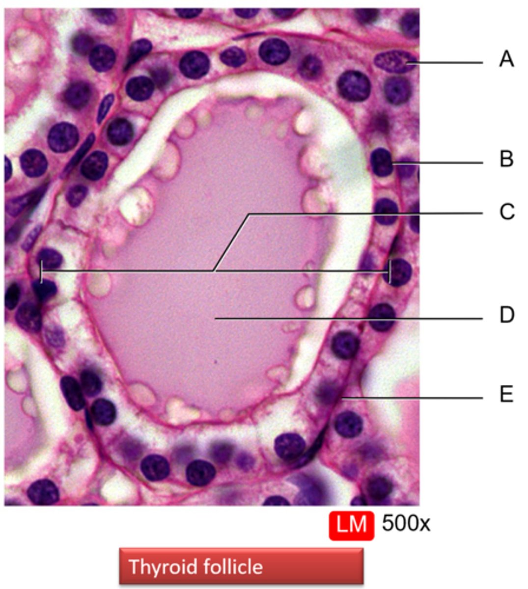 <p>Label this histological slide of a thyroid follicle</p>