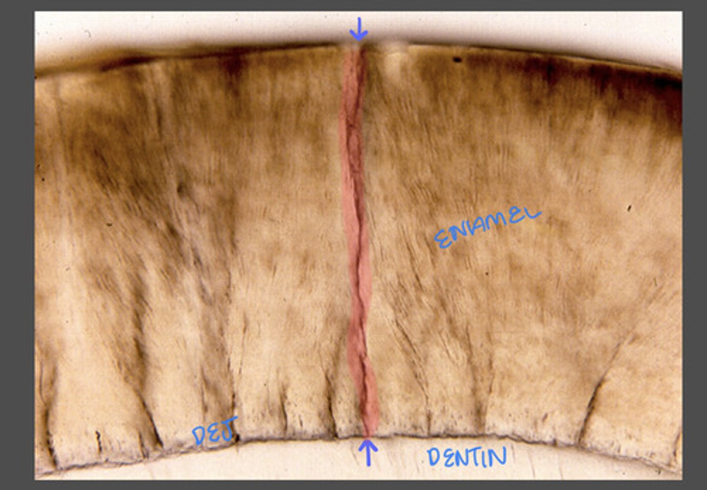 <p>Fissure-like linear enamel defects containing proteins proteoglycans, and lipids.</p><p>Enamel lamellae extends along the longitudinal axis of the tooth perpendicular to the dentin enamel junction.</p>