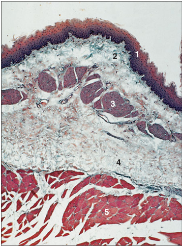 <p>Identify the structure:</p><p>Specie:</p><p>Parts:</p><p>1.__ 2.__ 3.__ 4.__ 5.__</p><p>Stain used:</p>