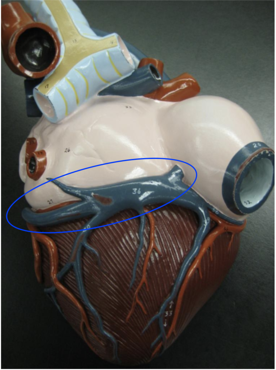 <p>posterior horizontal vein </p>