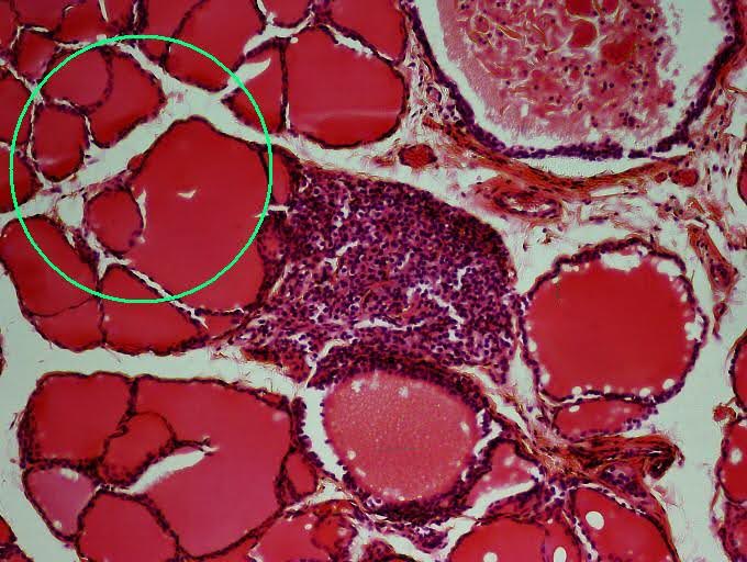 <p><span><span>Name a hormone produced by the indicated endocrine gland.</span></span></p>