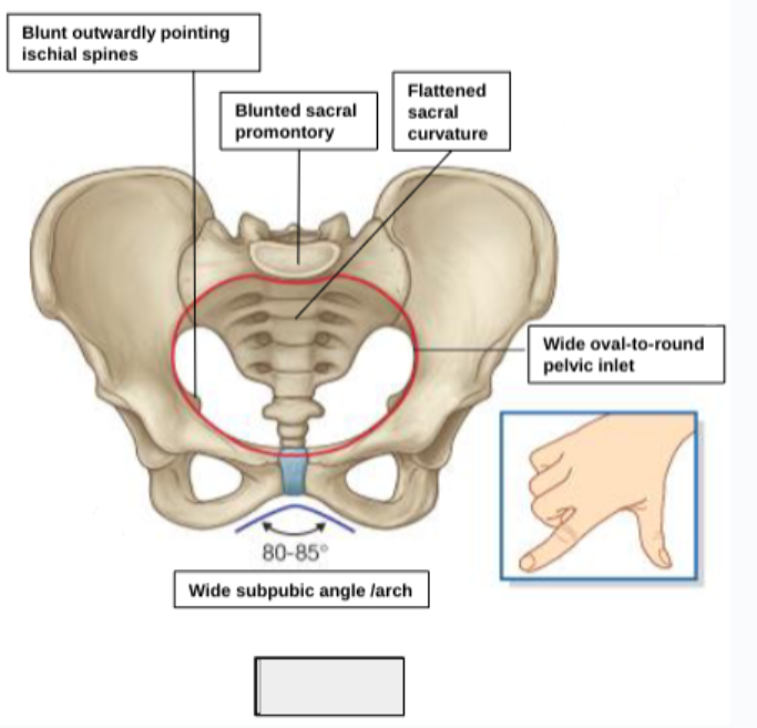 <p>male or female pelvis?</p>