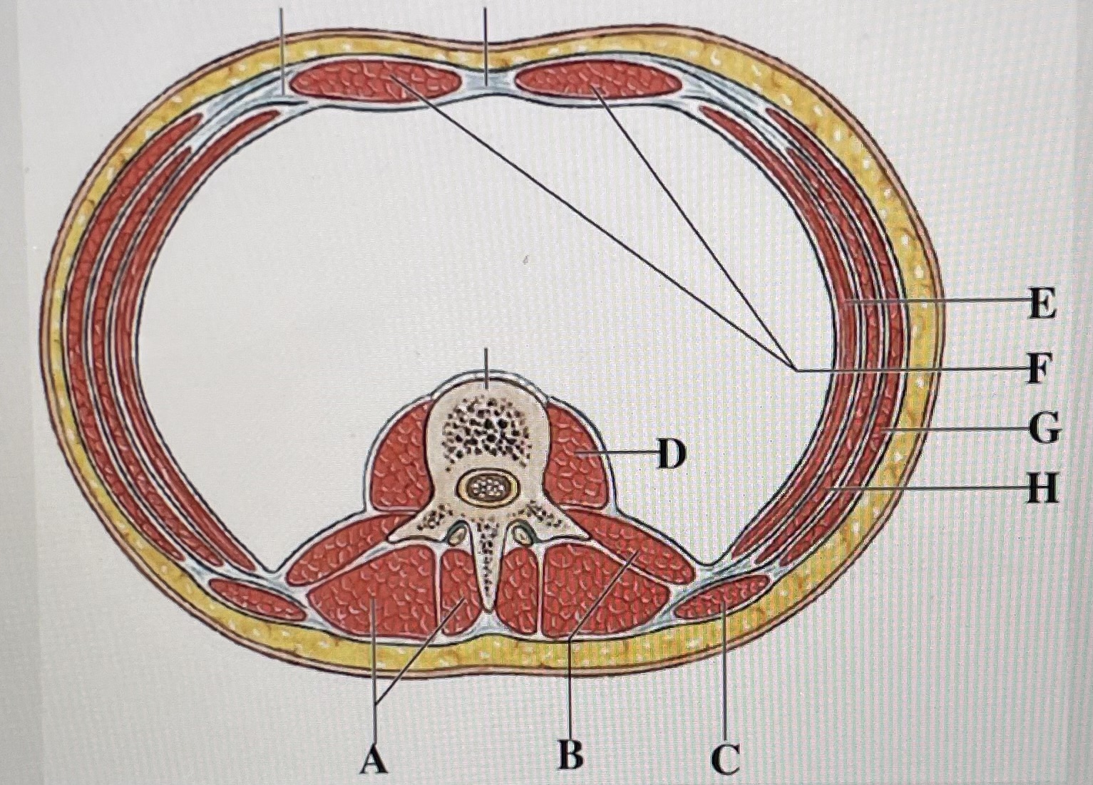 In the figure above,  *is the external oblique and* _ is the transverse abdominis 