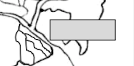 <p>What is the name of this?</p>