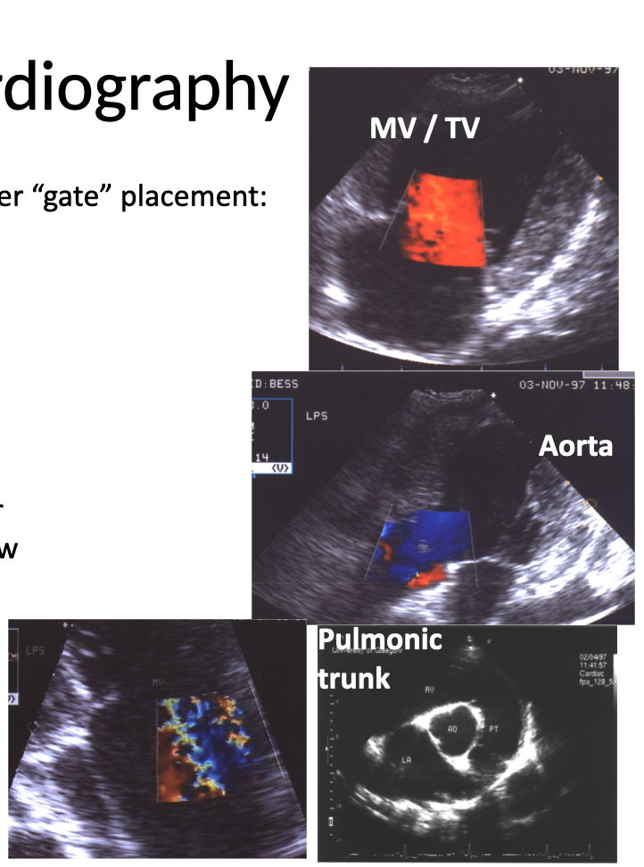 <ul><li><p>B-mode images guide the Doppler āGateā placement</p></li></ul><p><strong>LPS 4/5 chamber views</strong></p><ul><li><p>Aorta (downward, blood depicted blue), MV & TV (Toward transducer (blood pictured red)</p></li></ul><ul><li><p><strong>RPS SA heart base view</strong></p></li><li><p>Pulmonic trunk (Away from transducer, blue)</p></li></ul><p></p><p><strong>Conventional Coloring System </strong></p><p><u>⢠BART system</u></p><p>⢠Blue = Depicts blood going away from transducer</p><ul><li><p>Aortic / Pulmonic outflow</p></li></ul><p>⢠Red = Depicts blood going towards transducer</p><ul><li><p>Mitral / Tricuspid inflow</p></li></ul><p></p><p><strong>Valvular incompetence </strong>- indicated by opposite color of flow in the wrong direction, turbulent flow - mosaic or multi-colored appearance</p><ul><li><p>Screens large areas of blood flow through heart to identify abnormalities</p></li></ul><p></p>