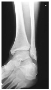 <p>What ankle view is this?</p>