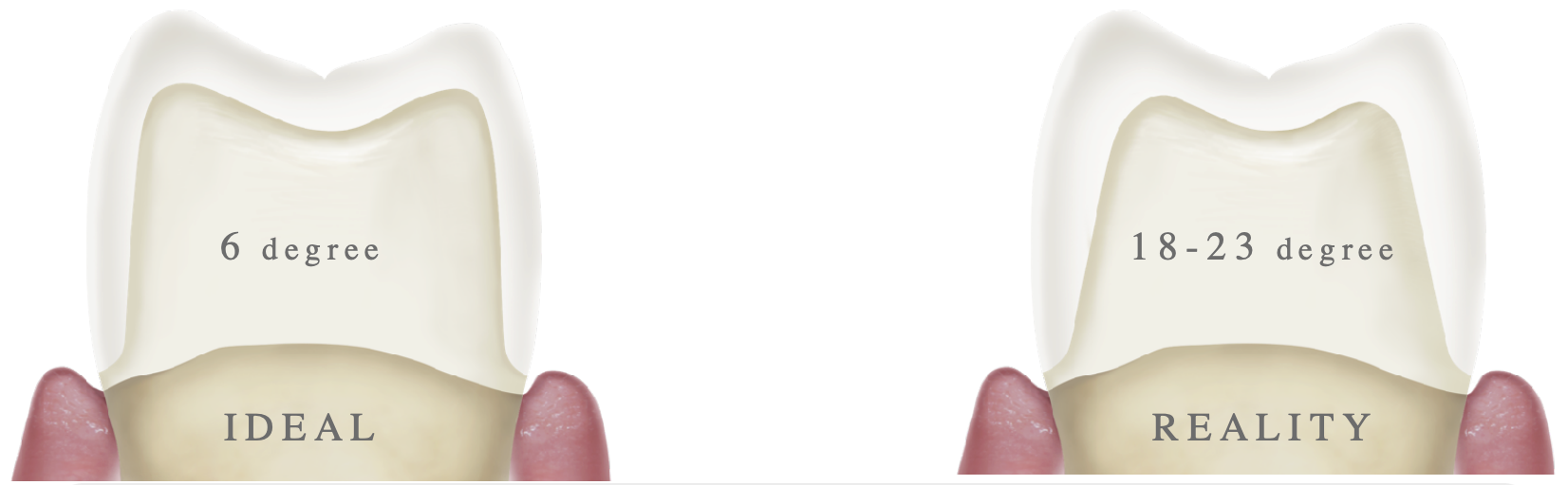 <ul><li><p>ideal: 6 degrees </p></li><li><p>reality: 18-23 degrees </p></li></ul><p></p>