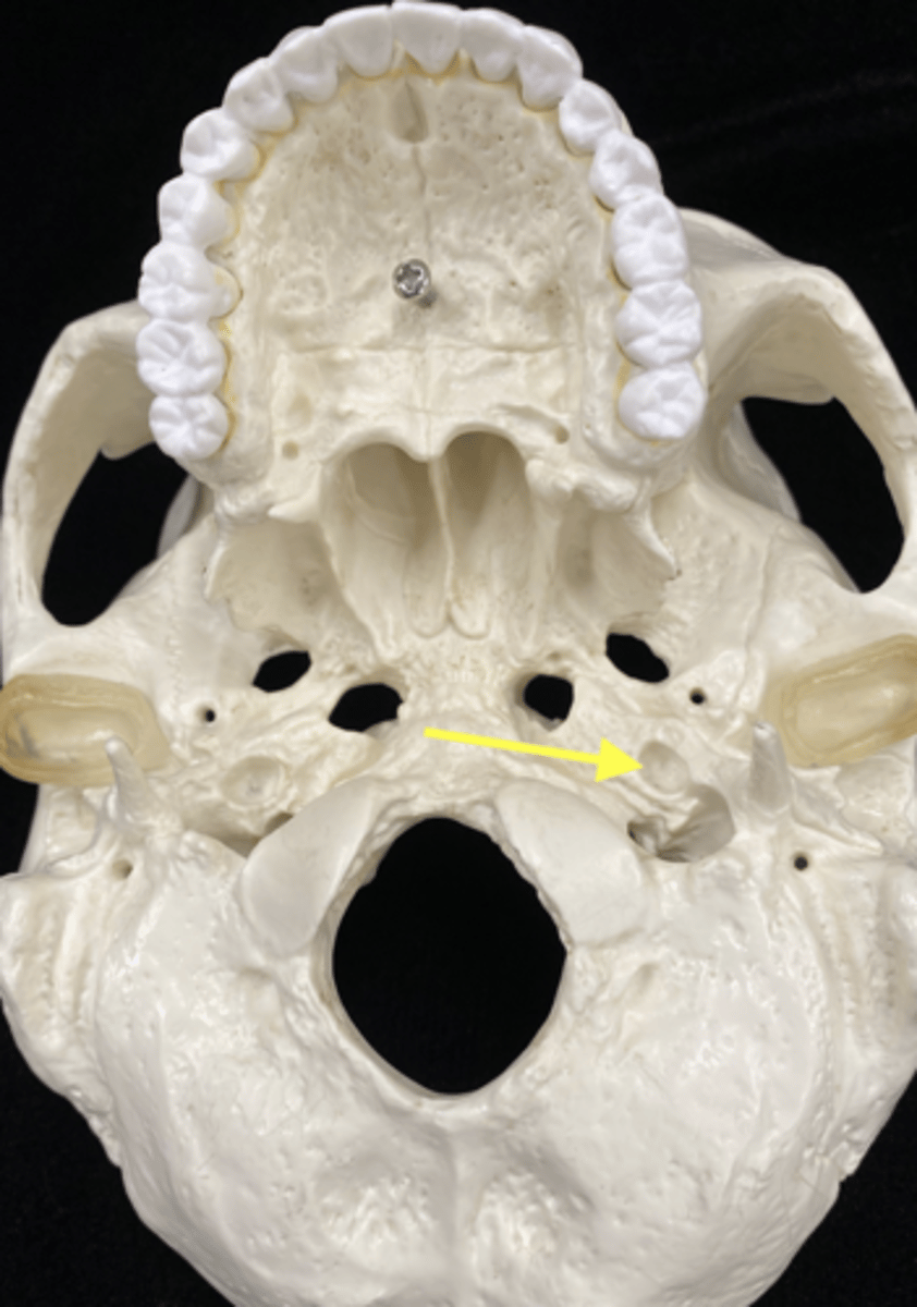 <p>name the bone and bone feature</p>