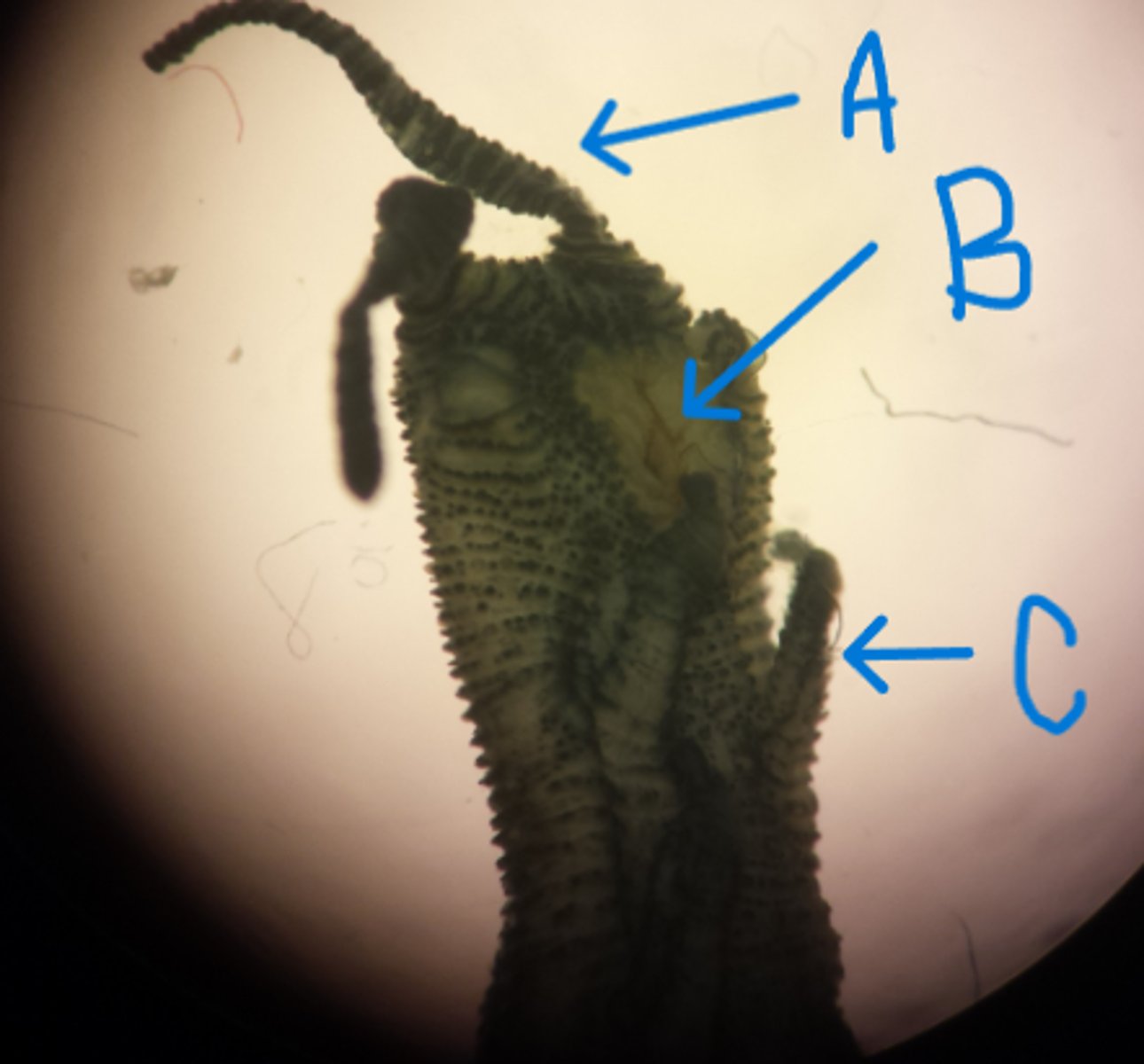 <p>What Superphylum and Phylum is this organism in?</p><p>What is A, B, and C pointing to?</p>