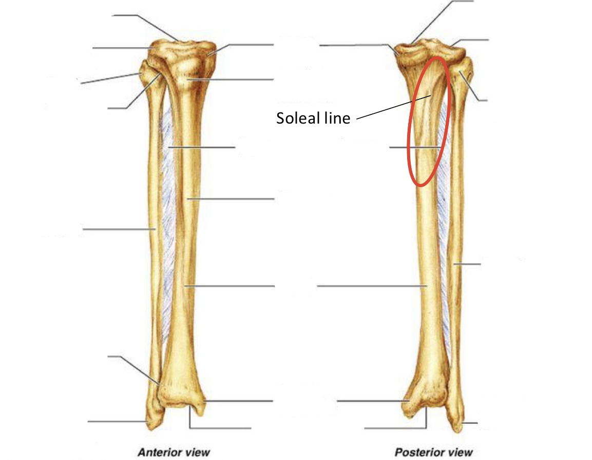 <p><span><span>Soleal line</span></span></p>