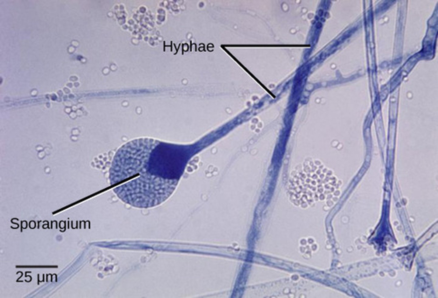 <p>sporangiospores</p>