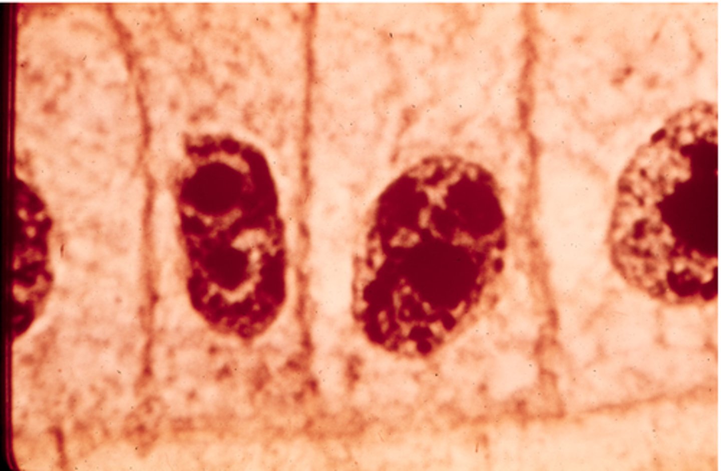 <p>This shows _______ in onion cells.</p>