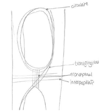 <p>Transeptale vezels</p>