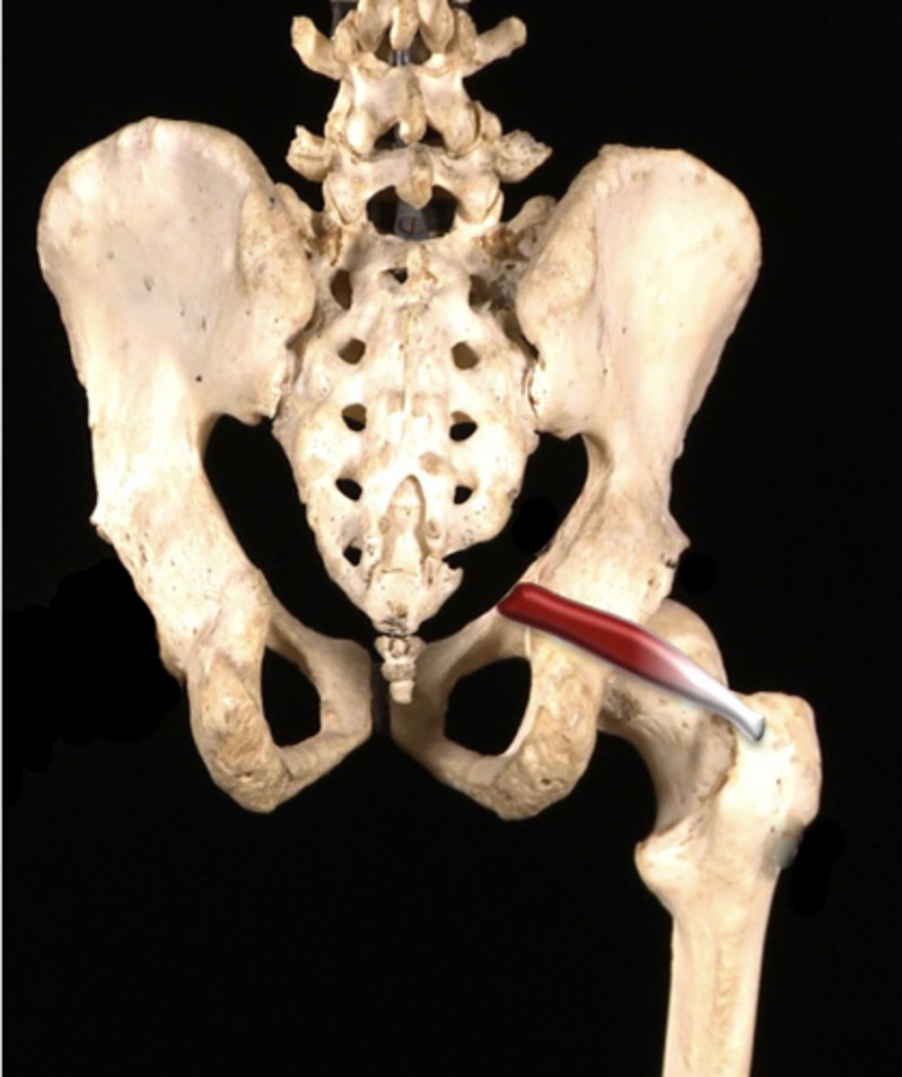 <p>ID muscle- laterally rotates hip</p>